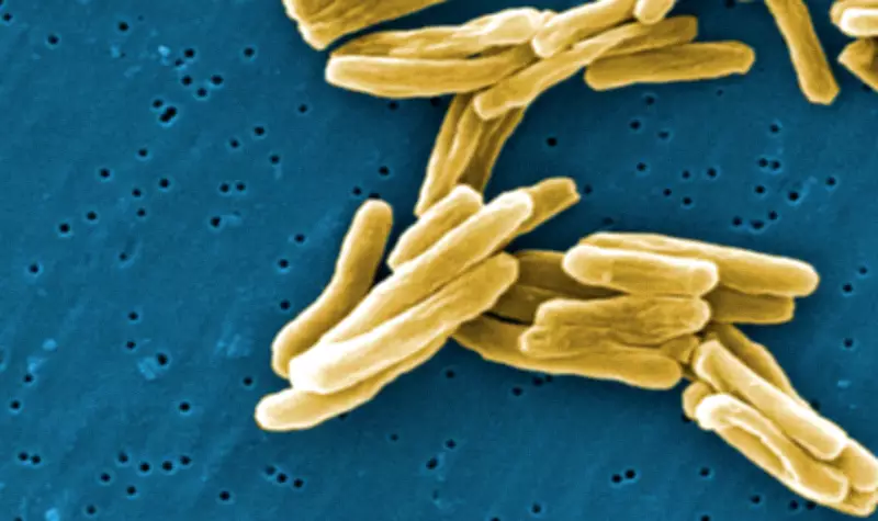 Saskatchewan's Tuberculosis Crisis: Among Highest Rates in Canada
