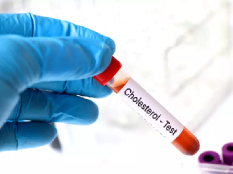 Updated Heart Guidelines Lower LDL Thresholds, Urge Earlier Screening