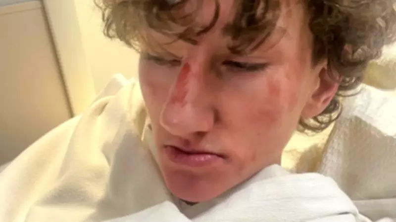 Youth Pleads Guilty in Wasaga Beach Assault Involving Métis Teen