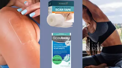 Silicone Scar Tape: How It Works and Top Products for Better Healing