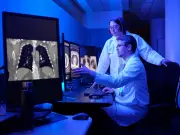 Debunking 7 Common Lung Cancer Myths: Expert Insights