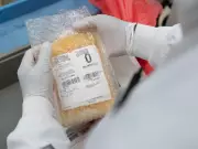 Health Canada Restricts Grifols' Plasma Collection License After Donor Deaths