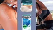 Silicone Scar Tape: How It Works and Top Products for Better Healing