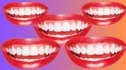 The Cultural Divide of American Smiles: How Perfect Teeth Spark Suspicion Abroad
