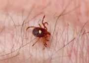 Ticks Arrive Early in Canada: Experts Warn of Lyme Disease Risk