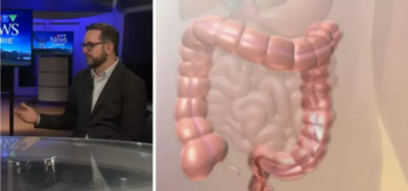 Barrie Ontario Lowers Colon Cancer Screening Age to 45