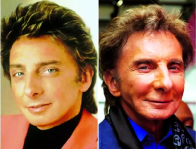 Barry Manilow, 82, admits to one facelift, denies Botox rumors