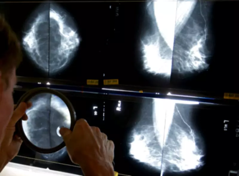 Breast Cancer Rates Vary Across Canada: Highest in Atlantic Provinces
