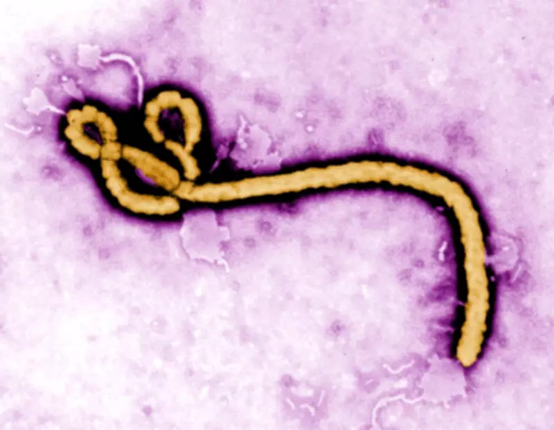 Dutch Hospital Admits Patient with Low Suspicion of Ebola