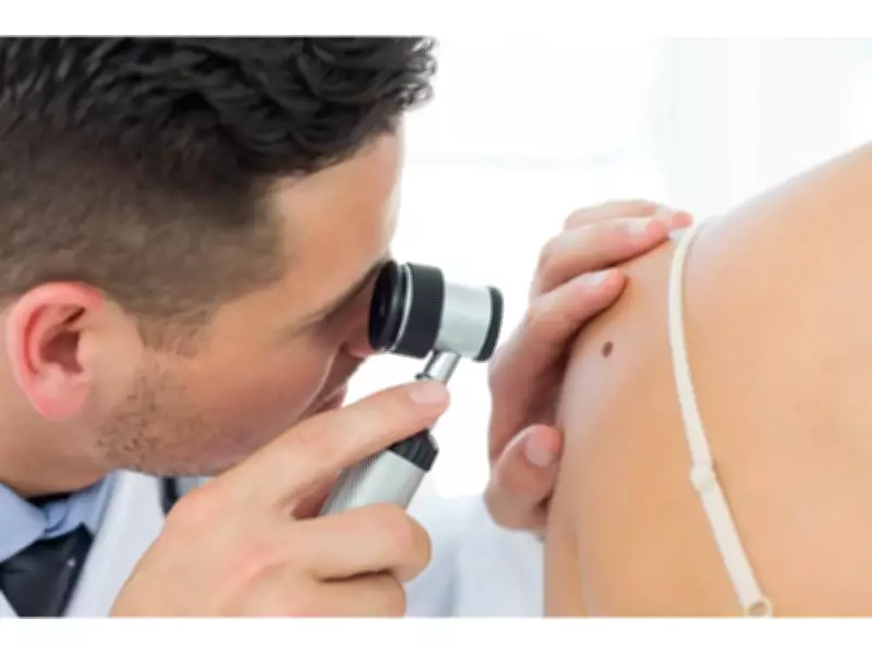 Free Skin Cancer Screenings on Parliament Hill by CDA and Melanoma Canada