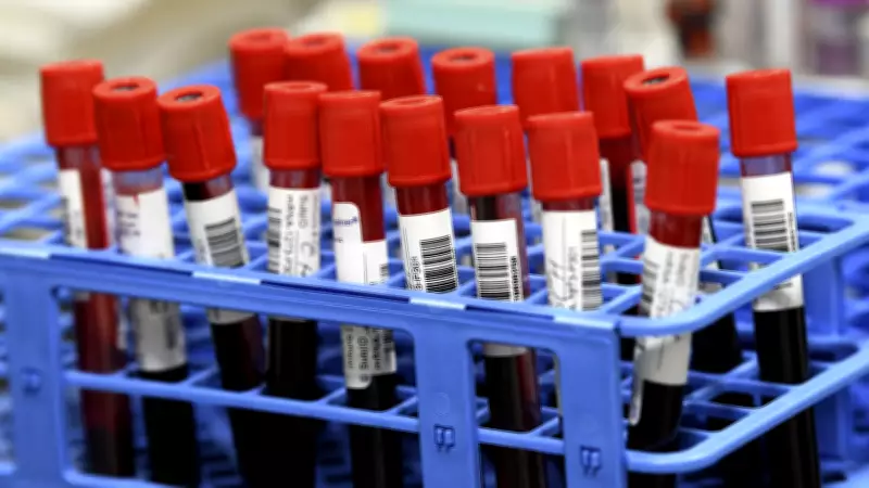 Halifax Residents Frustrated Over Bloodwork Backlog Issues