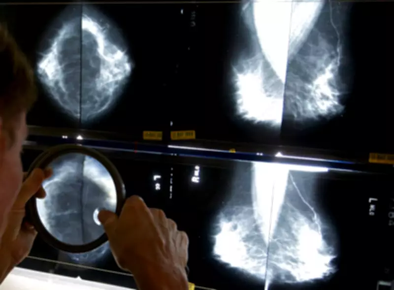 High Breast Cancer Rates in Canadian Regions: Study