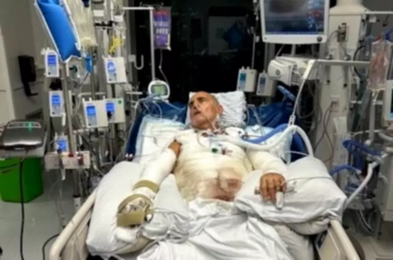 Montreal Man Sues Ferrari Quebec After Explosion Causes Severe Burns