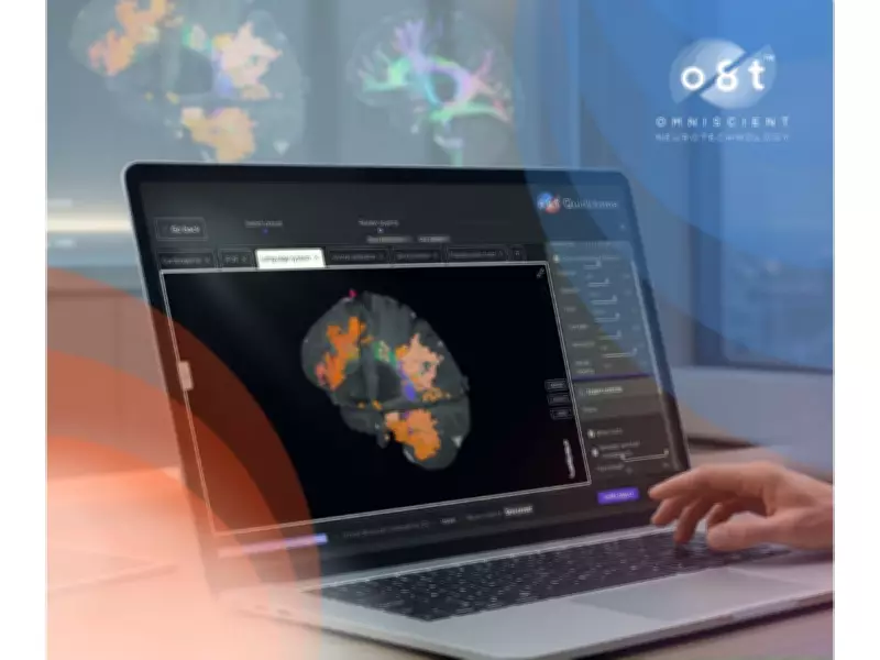 Omniscient Raises $27.2M Series D for AI Brain Tech