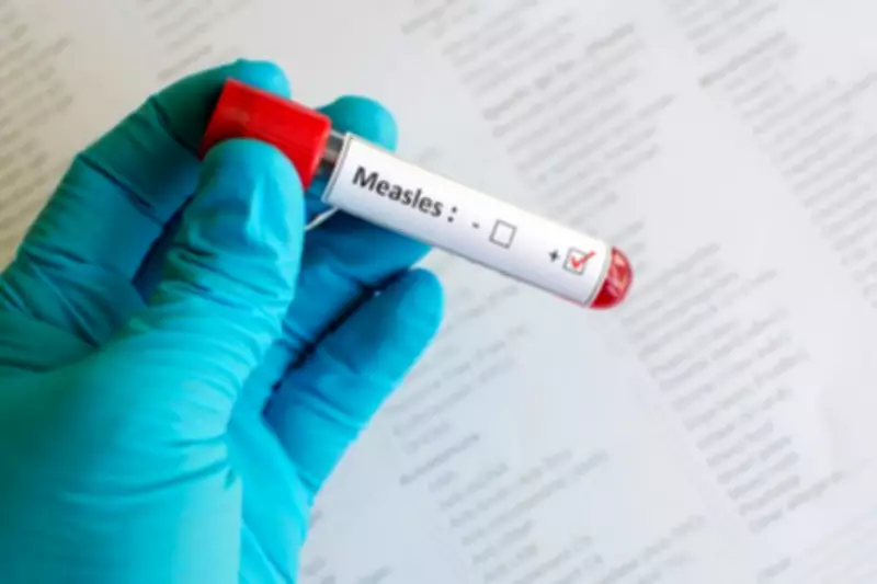 Red Deer Seniors Facility Visitors Warned of Possible Measles Exposure