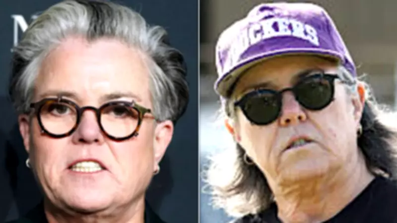 Rosie O'Donnell's Face-Lift Poem: A Celebrity Confession