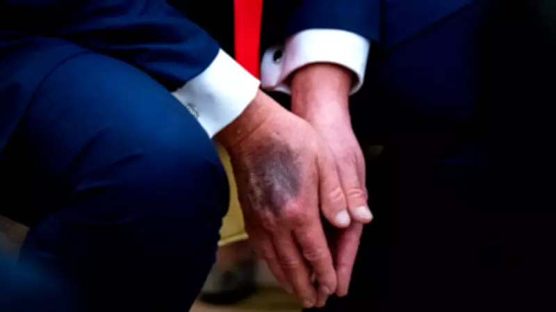 Trump's Physical Exam Unlikely to Reveal Mental Health Insights