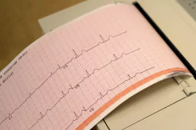 Rise in Heart Failure Among Young Canadians: 'Couldn't Walk Five Feet'