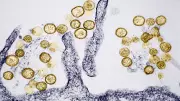 Colorado Man Dies from Hantavirus; No Link to Cruise Ship Outbreak