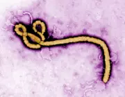 Dutch Hospital Admits Patient with Low Suspicion of Ebola