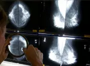 Manitoba Expands Breast Cancer Screening Access in Southern Region