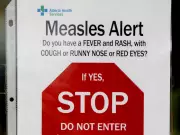 Measles Exposure Alert Issued for Calgary Hospital Emergency Departments