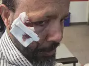 Police Probe Hate-Motivated Assault on Muslim Man in St. Albert