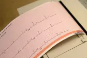 Rise in Heart Failure Among Young Canadians: 'Couldn't Walk Five Feet'