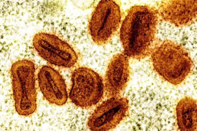 2 Scientists Charged for Bringing Deactivated Mpox Virus into US, Lying to Authorities