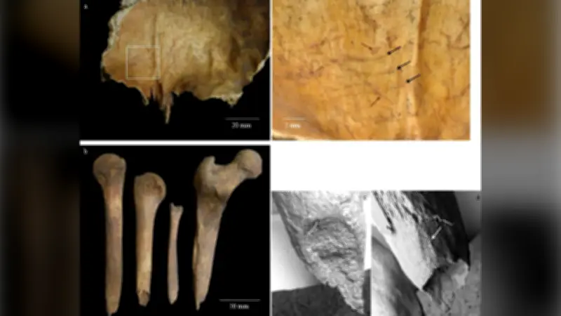 Ancient Burial Rituals: Brain Removal and Bone Sharpening in Iron Age