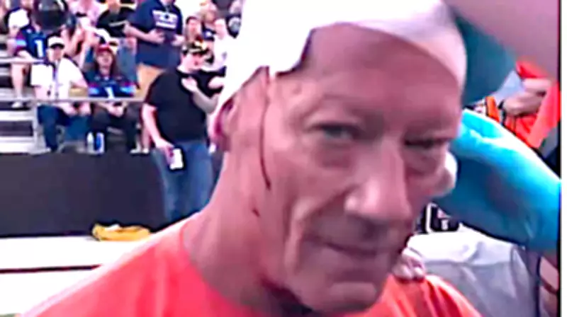 Fox Sports Cameraman Dave Bloodied but Blows Kiss After Sideline Collision