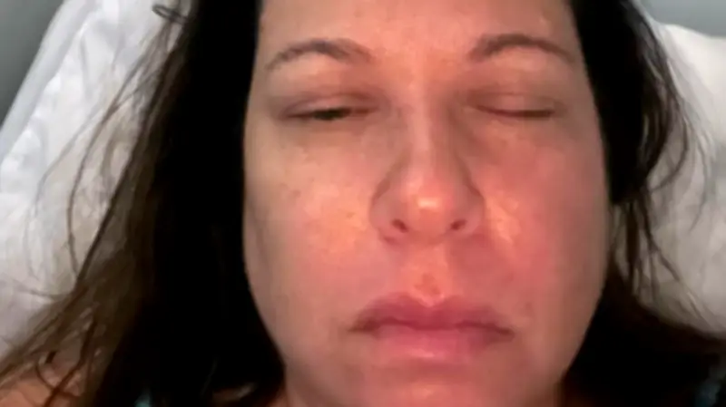 Living with 'Suicide Disease': A Personal Account of CRPS