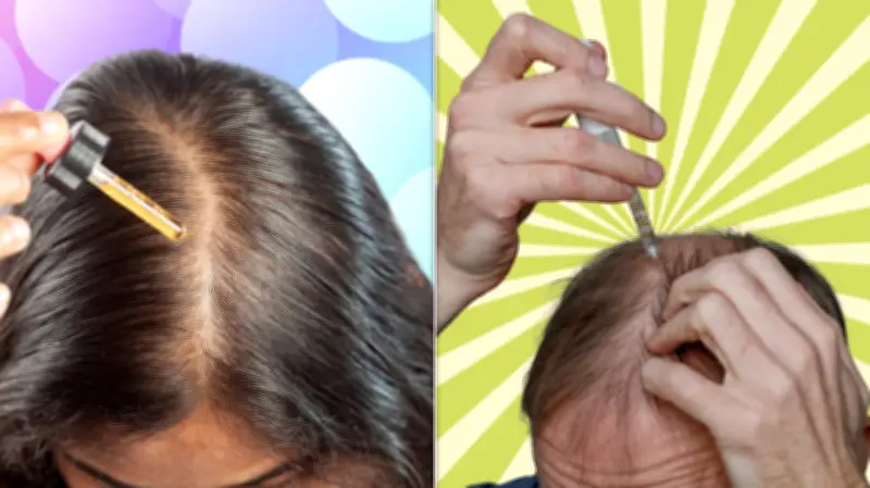 Minoxidil for Hair Loss: Dermatologists Warn Against Preventive Use