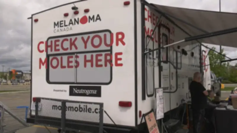 Mobile Skin Cancer Checks Offered at Edmonton Tour Stop