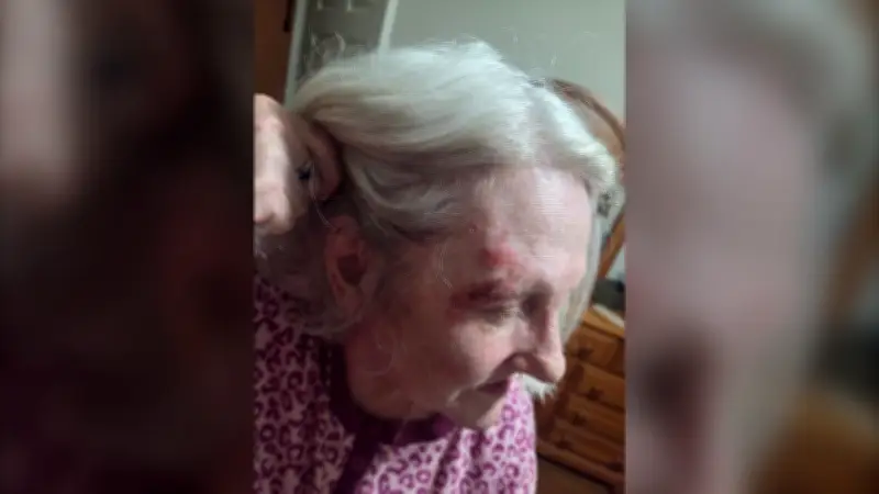 Moncton senior dragged by her own vehicle during theft injured