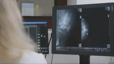 B.C. mammogram results delayed due to critical technician shortage