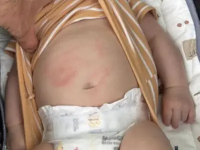 Calgary dad says boy on scooter hit his sleeping baby in stroller
