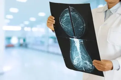 Canadian study: Less breast cancer treatment may be as effective with fewer side effects