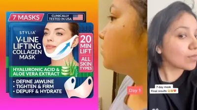 Collagen Chin Masks 18% Off: Reviewers Say They Lift and Tighten Jawline