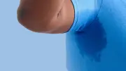 9 Best Products for Excessive Sweating, Recommended by Dermatologists