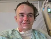 California McDonald's Employee in ICU After Hot Oil Attack by Coworker