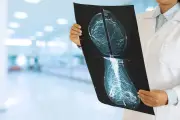 Canadian study: Less breast cancer treatment may be as effective with fewer side effects