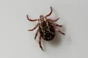 Lyme disease rising in Canada but underdiagnosed: tick protection tips
