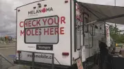 Mobile Skin Cancer Checks Offered at Edmonton Tour Stop