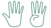Thumb Test: Simple Home Check for Aortic Aneurysm Risk