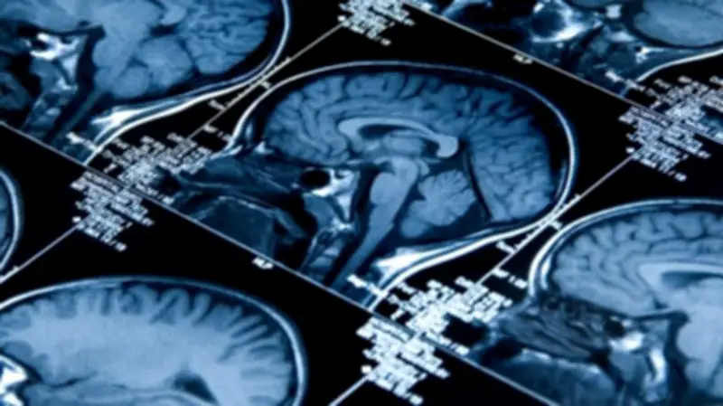 McMaster Researchers Develop New Therapy to Prevent Brain Cancer