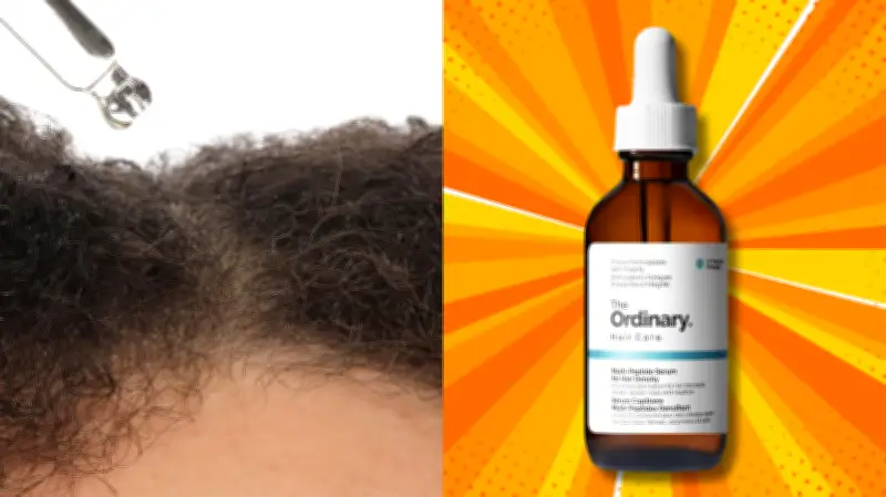 Peptides for Hair Loss: The Ordinary Serum That Works