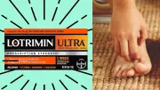Lotrimin Ultra: Prescription-Strength Athlete's Foot Cream That Works
