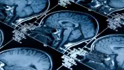 McMaster Researchers Develop New Therapy to Prevent Brain Cancer